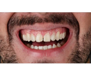 dr_danillo_aed_3_1